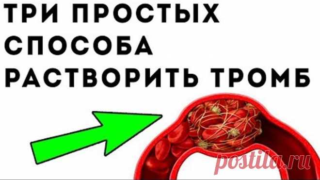 Как растворить ТРОМБ. Важные рецепты для здоровья