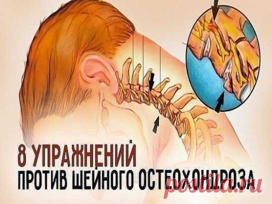 Первые проявления шейного остеохондроза — боли в спине, головные боли, головокружение, 