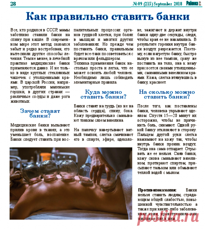 Как правильно ставить банки