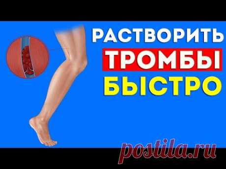 ЭТИ продукты БЫСТРО растворяют ТРОМБЫ в сосудах. Тромбоэмболия, варикоз, профилактика тромбоза