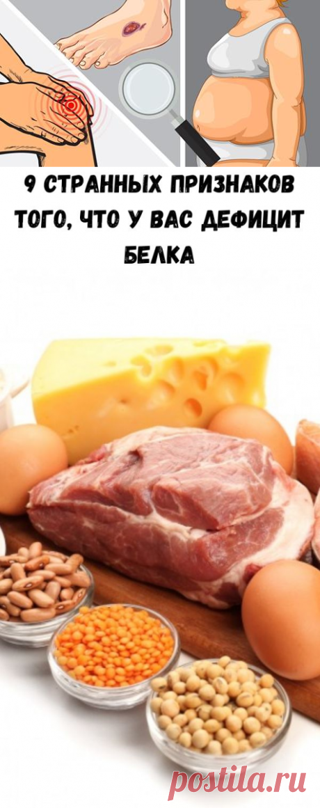 9 странных признаков того, что у вас дефицит белка - Советы на каждый день