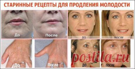 СТАРИННЫЕ РЕЦЕПТЫ ДЛЯ ПРОДЛЕНИЯ МОЛОДОСТИ

Дорогие женщины, недавно нашла такие классные рецепты для продления молодости! Сама пробую, и нарадоваться не могу! Кожа стала гладкой, лицо подтянулось, круги под глазами испарились, морщины уменьшились, короче говоря, помолодела лет на 7 так точно! 
Теперь делюсь рецептами с вами:
1.	Ежедневно выпивайте натощак смесь из 1 ч. ложки жидкого…
Продолжение в группе — ok.ru/real.women
•••подробнее