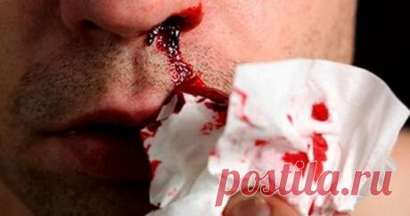 Когда мы не лечим, а калечим: 9 страшных ошибок при оказании первой помощи — Полезные советы