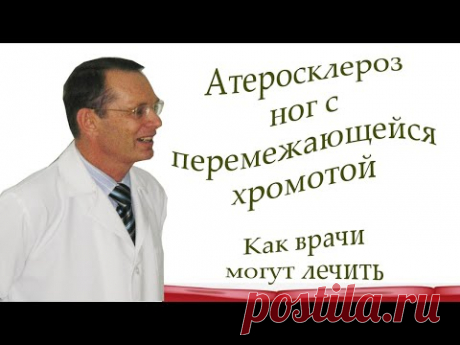 Атеросклероз ног с перемежающейся хромотой.Как врачи могут лечить.Видеобеседа для ВСЕХ и для врачей.