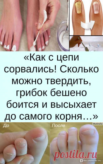 Скажем грибку нет! Как вылечить грибок без хирургии в домашних условиях.
БЛОГ - ВСЕ О КРАСОТЕ И ЗДОРОВЬЕ НОГТЕЙ ОТ ЕЛЕНЫ СОКОЛОВОЙ.
Итак, для начала, что такое грибок?

Грибок - это инфекция. Оседая на коже, она вызывает размягчение и разрушение верхнего слоя эпидермиса, от чего появляется сухость. Далее споры грибка проникают в наш организм и паразитируют, разрушая белковые клетки и питаясь ими.
летний маникюр
От этого наши ногти утолщаются, слоятся и приобретают неприятный