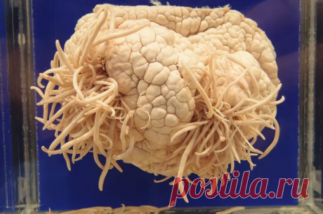 Паразит, который всем деликатесам предпочитает человеческий мозг