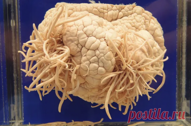 Паразит, который всем деликатесам предпочитает человеческий мозг