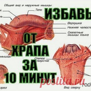 КАК ЗА 10 МИНУТ ИЗБАВИТЬСЯ ОТ ХРАПА НАДОЛГО