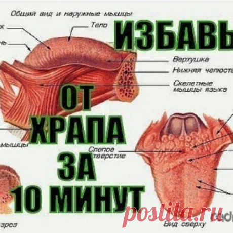 КАК ЗА 10 МИНУТ ИЗБАВИТЬСЯ ОТ ХРАПА НАДОЛГО