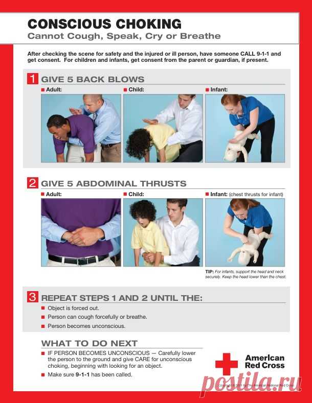 Прием Геймлиха