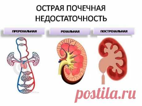 Симптомы почечной недостаточности: 8 признаков заболевания