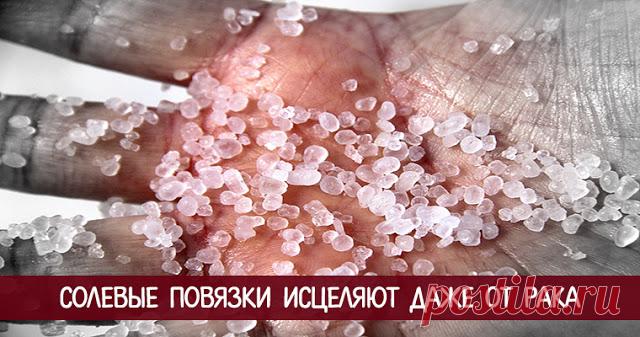 Солевые повязки исцеляют даже от рака 

 
Солевые повязки исцеляют даже от рака
 
Этот рецепт был опубликован в ЗОЖ в 2002 г. К сожалению, не хорошо забыт, а специально вытравлен из памяти и дискредитирован фармацевтическими компаниями в …