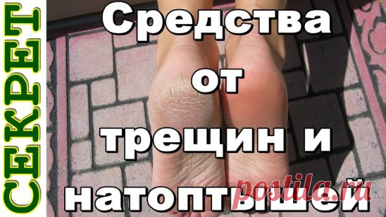 Как убрать мозоли и вылечить трещины на пяточках?
Мозоли, особенно застарелые, натоптыши, трещины на пяточках способны доставить немало проблем. Мало того, что они нарушают эстетическую красоту наших ножек, но и могут причинить болевые ощущения. Мы подготовили для вас подборку наиболее эффективных средств удаления сухих, застарелых мозолей и лечения трещин кожи пяточек.
Проверенные средства от мозолей, натоптышей и трещин:
1-й рецепт (содово-мыльный раствор от натоптышей): необходимо ежедневн