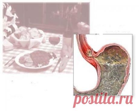 Гастроэзофагеальная рефлюксная болезнь: симптоматика, причины возникновения и лечение :: SYL.ru