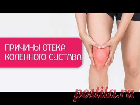 Убираем отек колена за 24 часа - без таблеток и мазей. Тейпирование коленного сустава