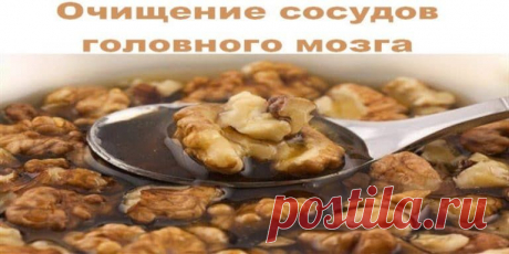 Очищение сосудов головного мозга — Кладовая полезных рецептов