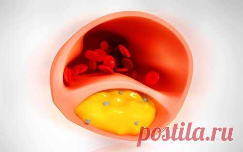 8 продуктов, которые помогут очистить артерии