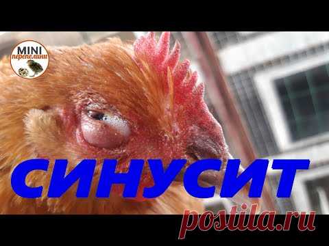 Лечим СИНУСИТ Лозевалем.