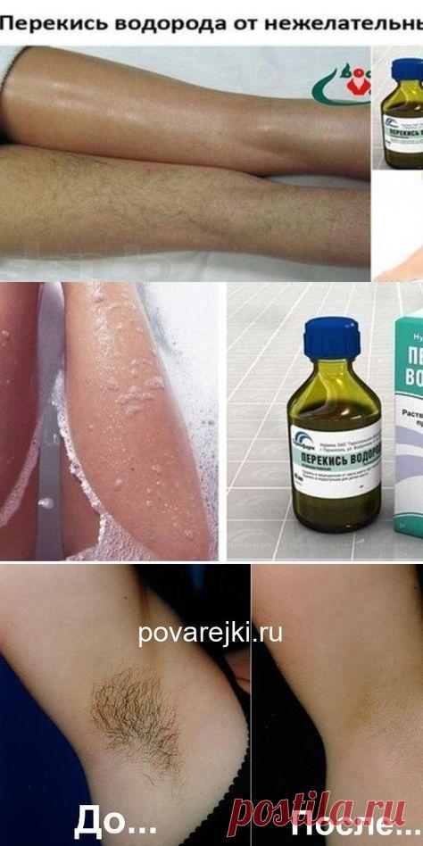 Перекись водорода от нежелательных волос