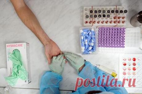 Россиянам рассказали о связи рака крови с ее группой. Риск развития любого онкозаболевания — это совокупность факторов, включающих в себя много показателей. Нельзя сказать, что носители определенной группы крови более подвержены риску развития рака. Об этом рассказал врач-онколог, врач-гематолог, врач-радиолог высшей категории профессор Александр Серяков.