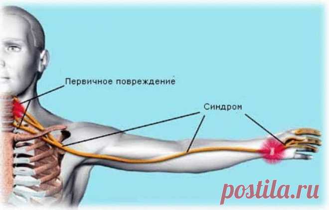 Почему при работе за компьютером болят руки или синдром лестничной мышцы