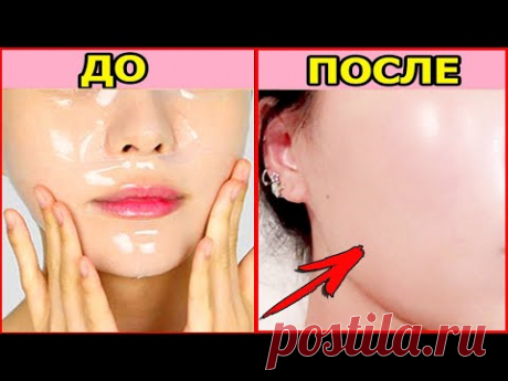 Кожа чистая как стёклышко! Корейский уход за кожей лица. Как очистить и вылечить проблемную кожу.