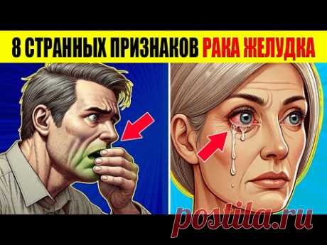 8 СТРАННЫХ ПРИЗНАКОВ РАКА ЖЕЛУДКА (Симптомы рака желудка)