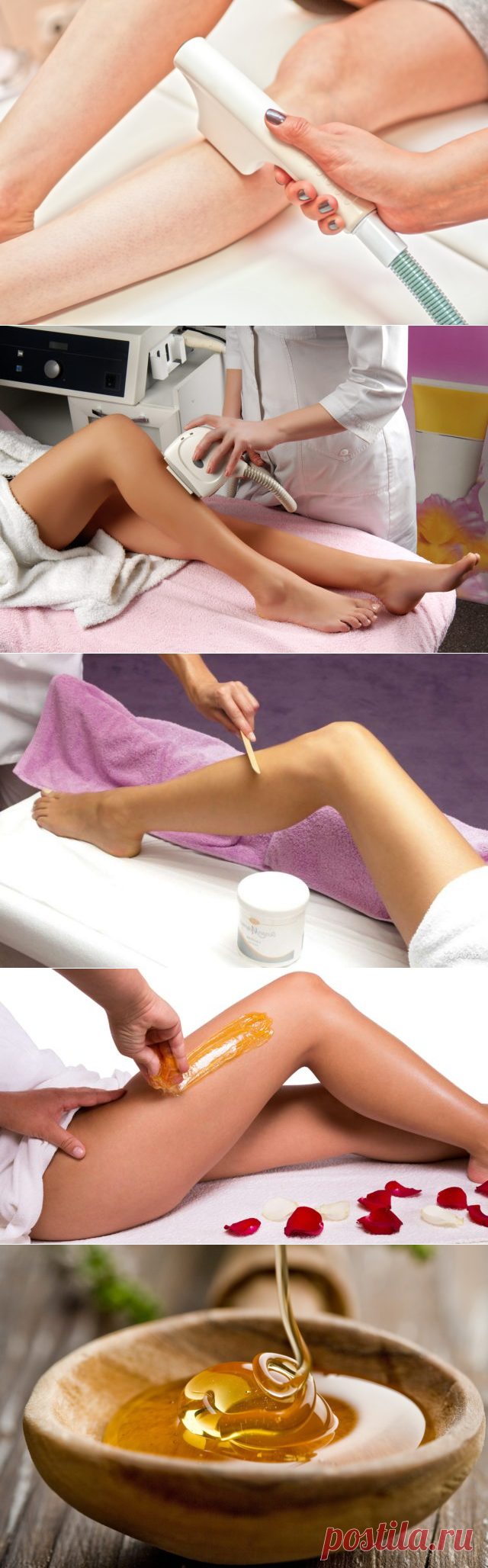 Что лучше — фотоэпиляция или шугаринг?