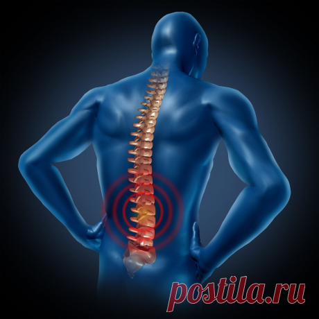 Сколиоз: неочевидные причины