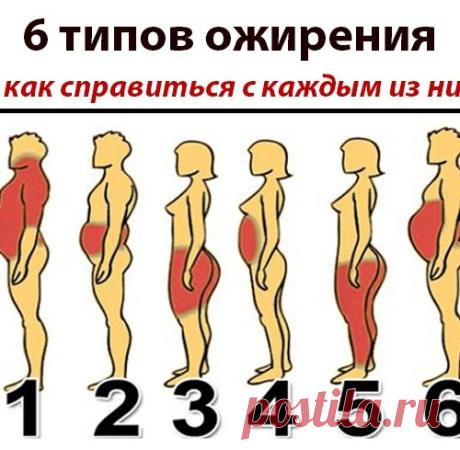 6 ТИПОВ ОЖИРЕНИЯ. КАК СПРАВИТЬСЯ КАЖДЫМ ИЗ НИХ