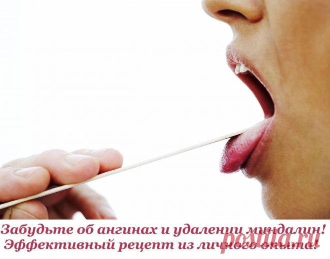 Забудьте об ангинах и удалении миндалин! Эффективный рецепт из личного опыта!

У сына были очень увеличенные миндалины, но болезни как таковой не было, ЛОР сказала, что это особенности строения. Так и жили с этим, болея не больше и не меньше других. Разве что только диатез первые три года мучил. Из-за диатеза лет в 5 лет вдруг дали отвод от очередной прививки ( новая терапевт пришла) и отправили к иммунологу.

Вот здесь начинается самое главное, в жизни встретился удивител...