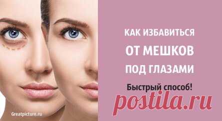 Как избавиться от мешков под глазами. Быстрый способ!