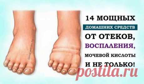 14 мощных домашних средств от отеков, воспаления, мочевой кислоты 

14 мощных домашних средств от отеков, воспаления, мочевой кислоты и не только! Быстрый и 100% результат!Вы страдаете от отёков ног, стоп, лодыжек, рук и лица, а также от воспаления и болей в сустава…