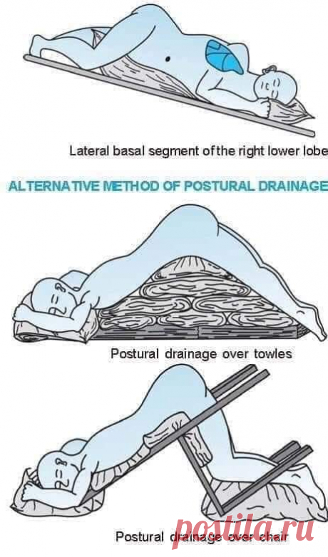 Эксперты рассказали о способе, который помогает вывести слизь из легких — Рамблер/доктор