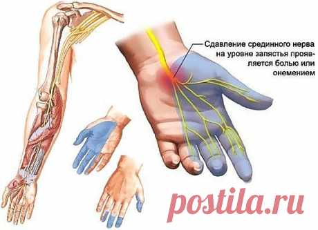 Одноклассники