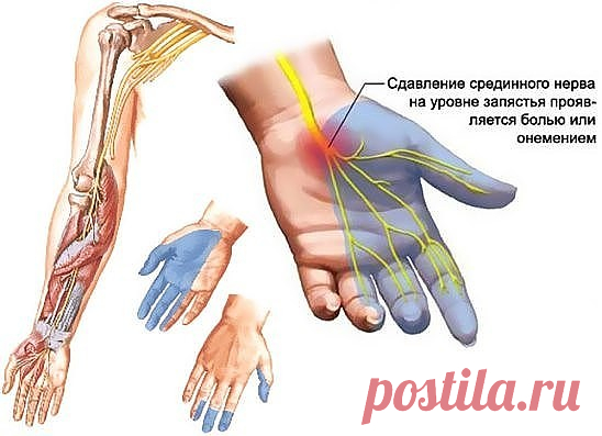 Одноклассники