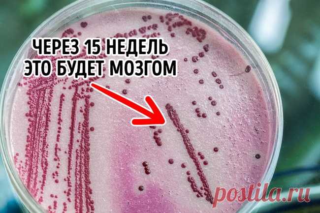 Органы, выращенные в пробирке.Ученые Австрийской академии наук потратили 15 недель, чтобы вырастить в чашке Петри самый важный орган человека — мозг. Лабораторный продукт имел тот же уровень развития, что и у 9-недельного плода. К счастью или сожалению, мыслить мозг не может, но это всего лишь вопрос времени, так как эксперименты продолжаются. В таком случае возникает вопрос: насколько качественно будет функционировать орган и не «слетит» ли он в будущем?