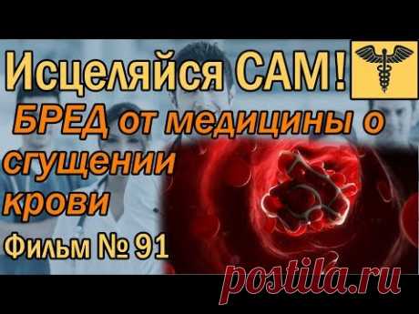 Разжижение крови и густая кровь - популярный бред некомпетентных медиков и блогеров