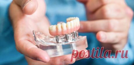 Имплантация зубов в Краснодаре