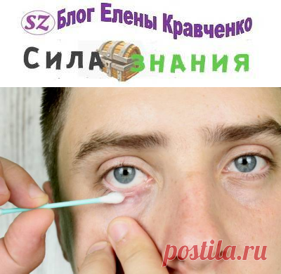 Как лечить ячмень на глазу в домашних условиях народными средствами