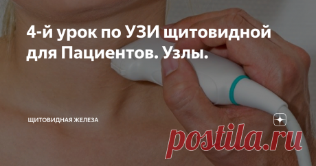 4-й урок по УЗИ щитовидной для Пациентов. Узлы. Этот урок посвящен описанию узлов, найденных в щитовидной железе. Вы не просто освоите перечень обязательных признаков, которые врач-УЗД должен указать в Протоколе УЗИ, но сможете понимать их значение.