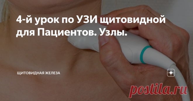 4-й урок по УЗИ щитовидной для Пациентов. Узлы. Этот урок посвящен описанию узлов, найденных в щитовидной железе. Вы не просто освоите перечень обязательных признаков, которые врач-УЗД должен указать в Протоколе УЗИ, но сможете понимать их значение.