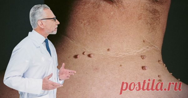 В борьбе с коварным врагом хороши любые методы. Действенные лекарства с полей и огородов!
