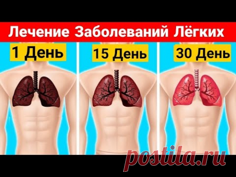 4 Домашних Средства Для Лечения Заболеваний Лёгких
