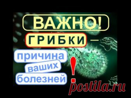 Здравствуйте, уважаемые зрители моего канала. Данное видео - мой последний вебинар о грибках (от 23 июня 16 г. - ), о болезнях к которым приводят те или иные...