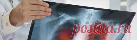 Рак легких ▷ лечение, признаки и симптомы рака легкого ⚕️ MedTour Рак легких ➤ диагностика, признаки, терапия и лечение рака легких ⚕️ Полное описание и новые методики лечения рака легких ⚕️ Все, что нужно знать про бронхогенную карциному ➤ какие симптомы заболевания, сколько стоит лечение рака легких ⚕️ Сколько стоит терапия рака легких узнайте в MedTour!