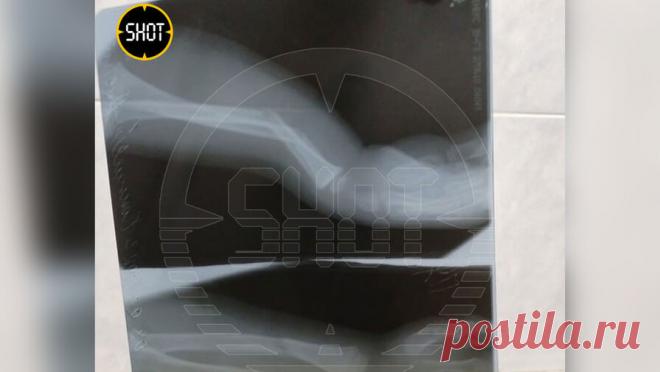 Четырехлетняя девочка сломала руку на прогулке в детском саду. В Смоленске четырехлетняя девочка упала во время прогулки в детском саду и получила перелом руки. Об этом сообщает Life со ссылкой на Telegram-канал Shot. По информации Telegram-канала, воспитатели дошкольного учреждения оставили группу ...