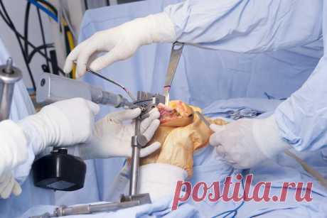 Эндопротезирование в Германии | Операции по заменам суставов.
В современной клинической практике имплантация суставов составляет значительную долю эндопротезирования. Под эндопротезированием понимают установку внутренних протезов – в отличие от внешнего протезирования (например, конечностей). К эндопротезированию относится установка искусственных сердечных клапанов, грудных имплантатов и т.п. Но первое место (по числу проводимых операций) стабильно принадлежит суставному эндопротезированию.