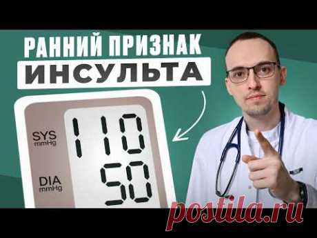 ТОП-5 ОПАСНЫХ Предвестников ИНСУЛЬТА. Как СПАСТИ СОСУДЫ Головного Мозга?