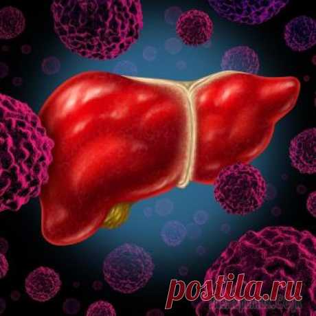 Рак печени – симптомы, признаки, стадии, диагностика и лечение